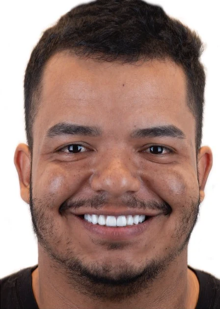 Retrato do paciente do primeiro caso
