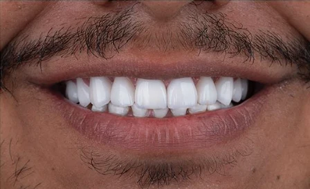Sorriso após o tratamento apresentado